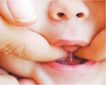 童途有「理」：口部運動 讓孩子唇尖舌利