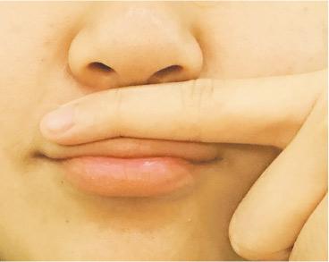 童途有「理」：口部運動 讓孩子唇尖舌利