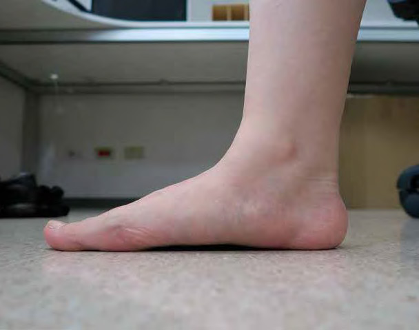 [GRWTH生活] 足弓健康勿輕忽 發育不好影響將由腳到脊柱（附伸展運動示範影片）