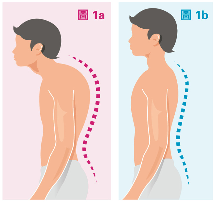 童途有「理」：預防低頭族駝背